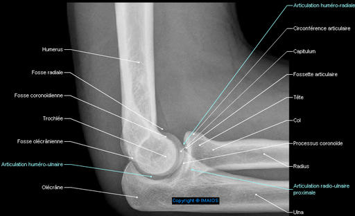 joint-elbow-radiology-lateral-view-en_medical512